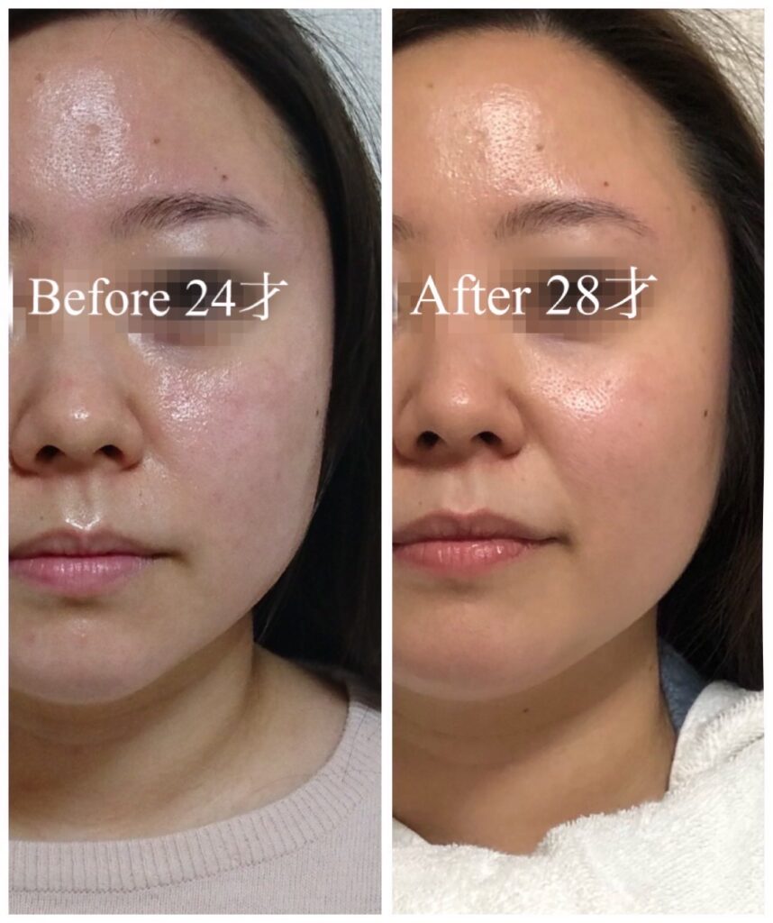 SPTM セプテム乾燥した肌を柔軟にししなやかな肌へ導くミルク